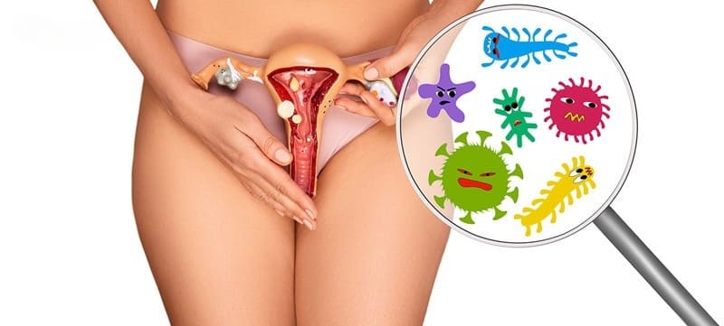 Làm sao để tránh viêm nhiễm phụ khoa?