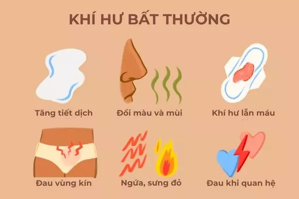 Nhiều câu hỏi